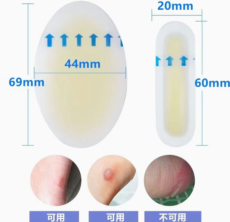 יצרן סין חבישה הידרוקולואידית 10 חבילות עם גבול 4' x 4' תחבושות הידרוקולואידיות גדולות עם תיקון גדול עם ריפוי מהיר עם דבק עצמי עבור כוויות כוויות שלפוחיות טיפול באקנה עמיד למים